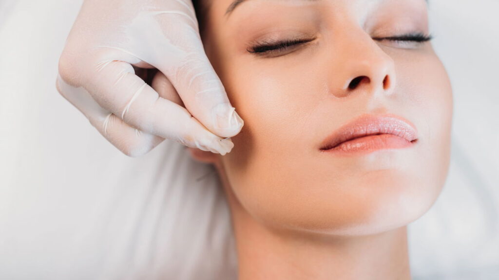 A cirurgia facial que virou moda entre famosas agora levanta alertas entre profissionais