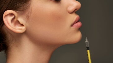 O que ninguém te conta sobre o preenchimento labial