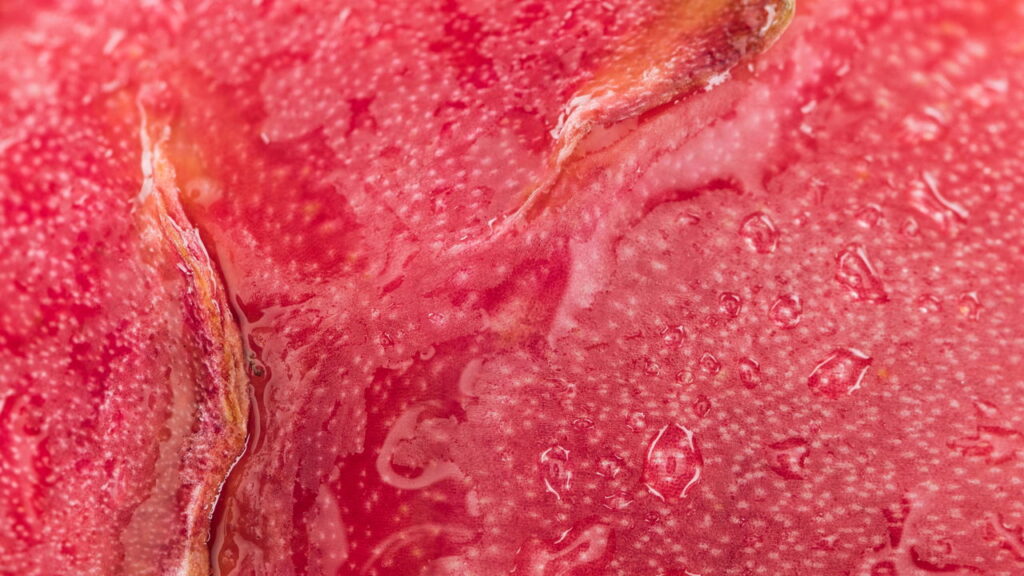 Essa fruta está conquistando os jardins brasileiros e o motivo surpreende