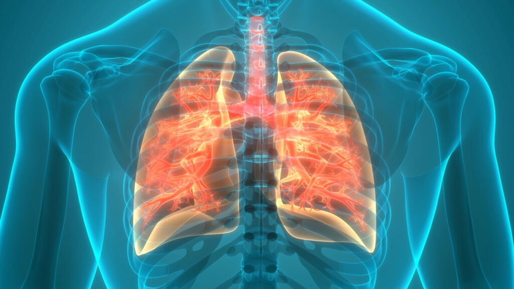 O que poucos falam sobre a tuberculose e por que isso preocupa o Brasil