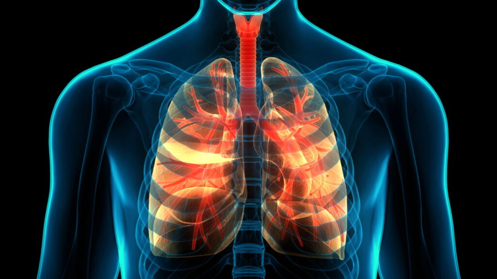O que poucos falam sobre a tuberculose e por que isso preocupa o Brasil