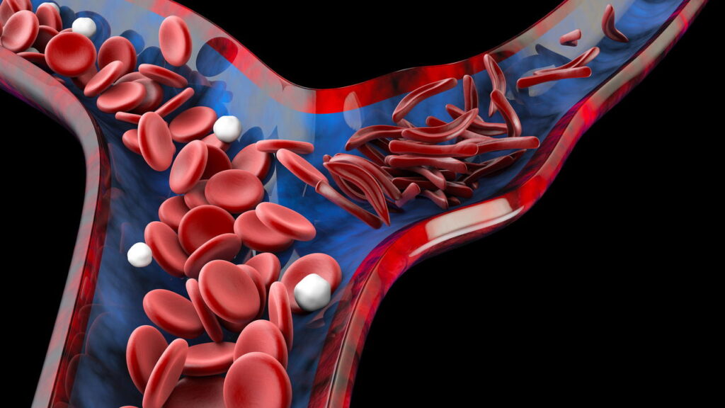 Circulação ruim nos pés? Entenda os sinais e como prevenir complicações