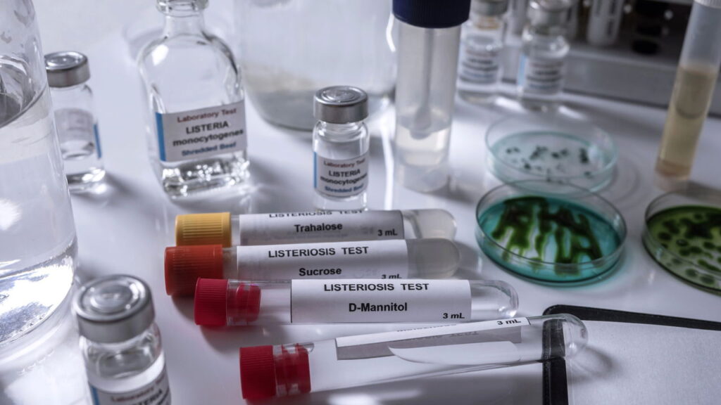 O que é listeriose? Veja como ocorre e como evitar a infecção alimentar perigosa