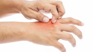 Você sentiu coceira na mão esquerda? Isso pode ter um significado surpreendente