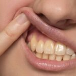 Quais alimentos mais mancham os dentes e como cuidar do esmalte de acordo com um dentista