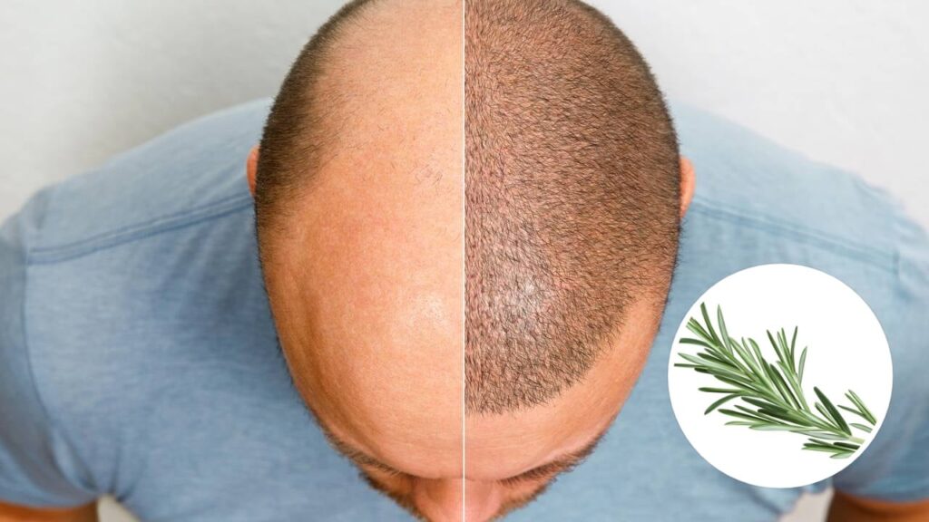 Uma forma simples e natural de fortalecer o cabelo e estimular o crescimento é usar a água de alecrim, um tônico fácil de preparar e cheio de benefícios - Créditos: depositphotos.com / arribalko, depositphotos.com / alina.88@inbox.ru