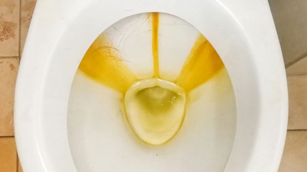 O acumulo de minerais, sujeiras e até mesmo o uso de produtos inadequados fazem o vaso ficar com manchas / Créditos: depositphotos.com / Thamkc